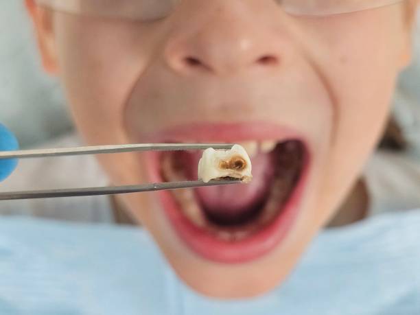 Best Emergency Care for Gum Disease in Evadale, TX